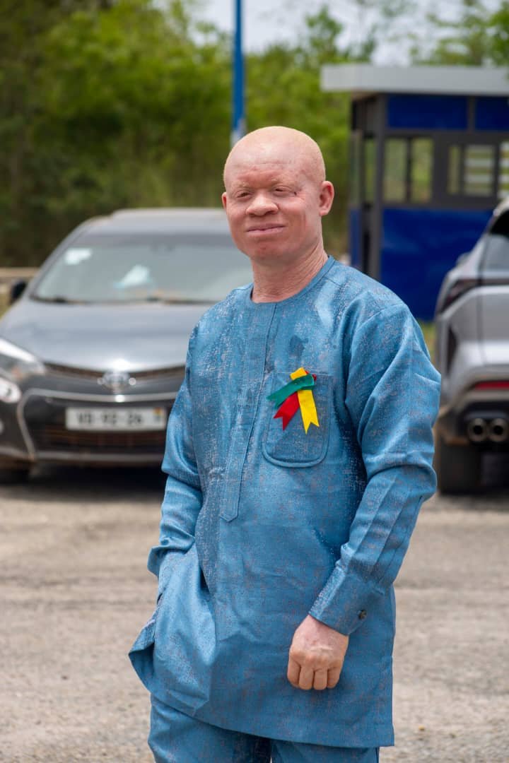 GAPA Commemorates 2026 International Albinism Awareness Day Under the Theme “Proudly in My Skin: Celebrating All Skin Tones”